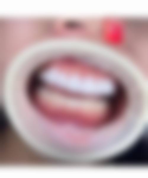 云南红河个旧惠爱口腔是正规医院吗？