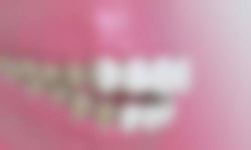 吴中美奥口腔诊所真人口碑评价怎么样?