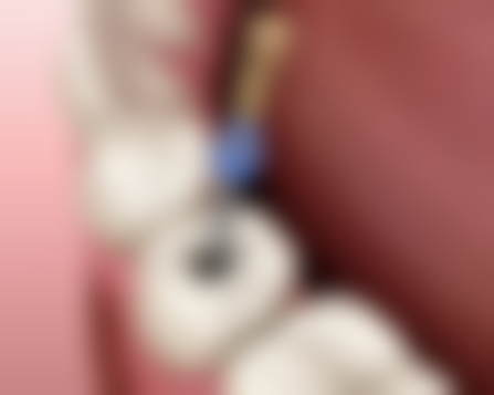 王大凯医生价格表