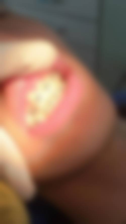 银川诺贝尔口腔：连锁品牌的正畸保护