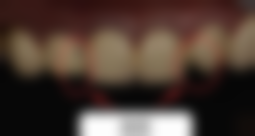 黑龙江牡丹江邢衍生口腔真人口碑评价怎么样？