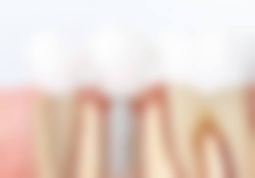 盐城林茂娟口腔诊所特色项目及技术优势