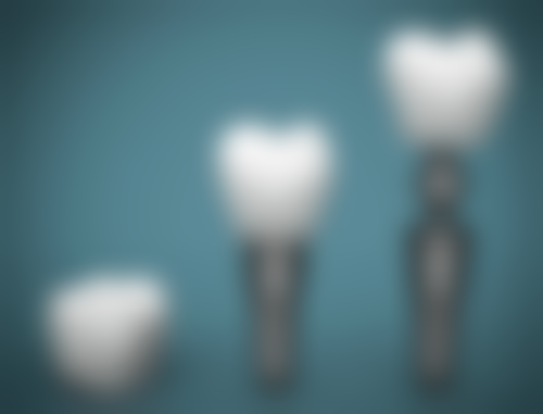 洗牙前避开生理期