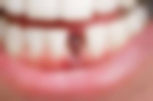 罗医生口碑评价及真人实例