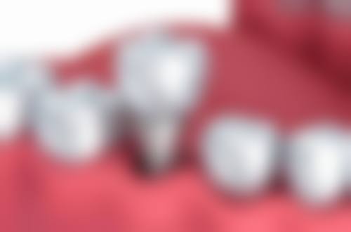 云南中 医 药大学第二附属医院口腔科真人口碑评价怎么样?