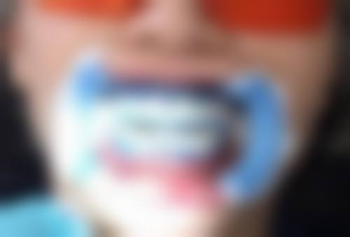 洗牙粉可以去除牙结石吗？无法清除坚硬牙结石，仅能清洁表面色素与软垢，建议专业洁牙