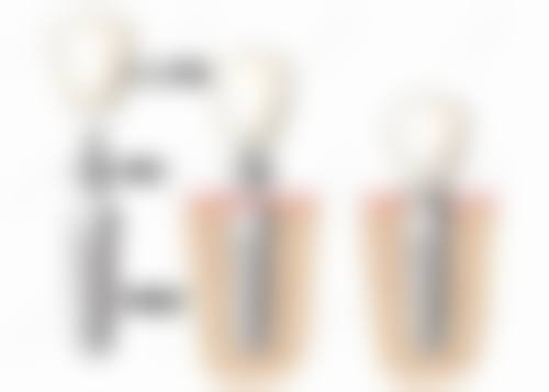 {东莞长安镇舌侧矫正医院24小时在线咨询：东莞仁华等4家医院强在哪？经验丰富医生+先进技术！ 