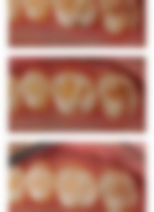 湖北平头牙匠(随州水西门店)地址电话营业时间