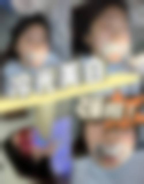 刘青医生的牙齿美白技术特色