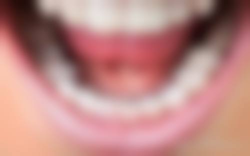 襄阳舌侧矫正技术特色:高端与挑战并存