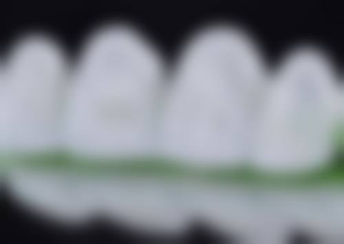 绍兴上虞任仕祥牙科诊所真人口碑评价怎么样？