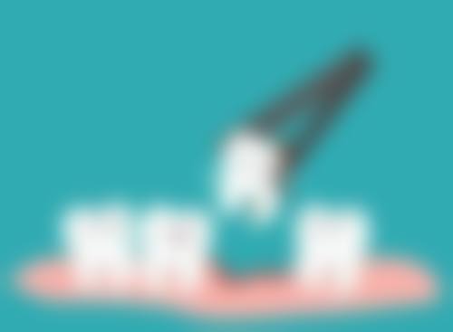 全瓷牙套的价格缺点