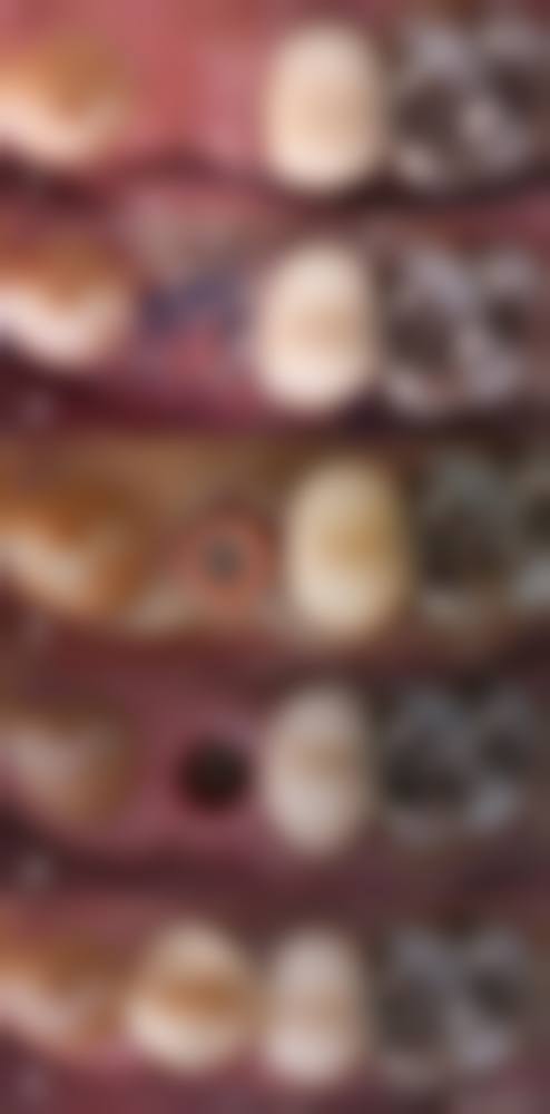 罗医生口碑评价及真人实例