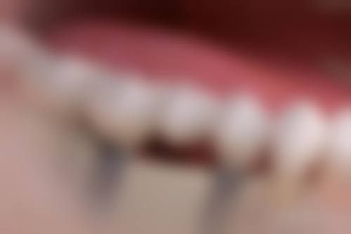 {永康比较好的牙科医院有哪些？浙爱、康美诺等口碑佳，种植牙3000起、矫正7999起！ 