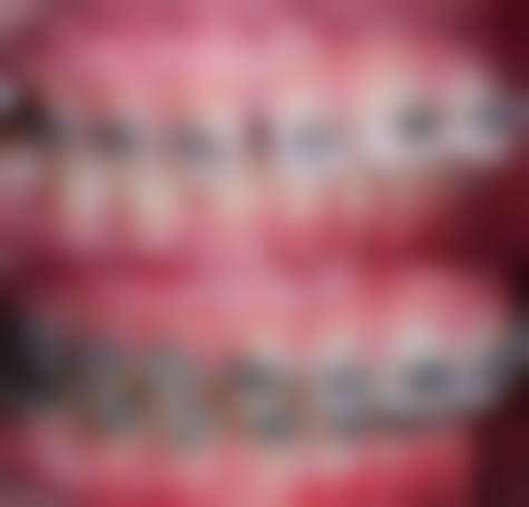 六、永康口腔收费标准：透明合理，性价比高