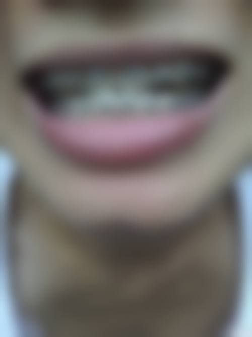 江苏南京贝奥口腔价格表/收费标准