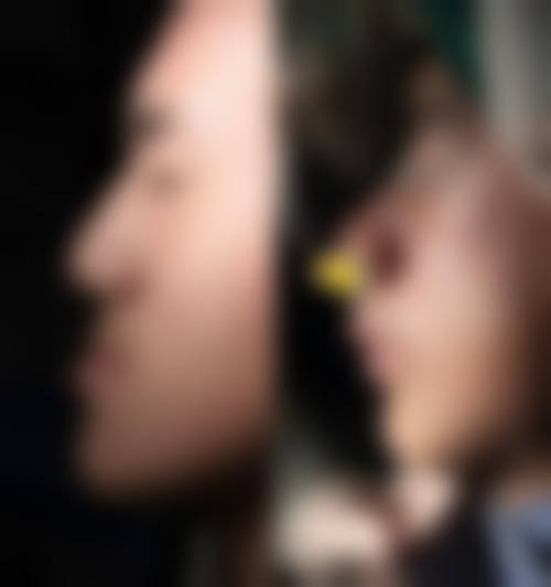 河南周口市川汇区赵博士口腔价格表/收费标准