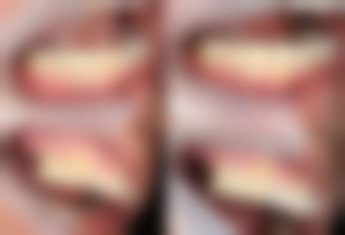 深圳华霆口腔诊所详细的预约挂号方式及流程