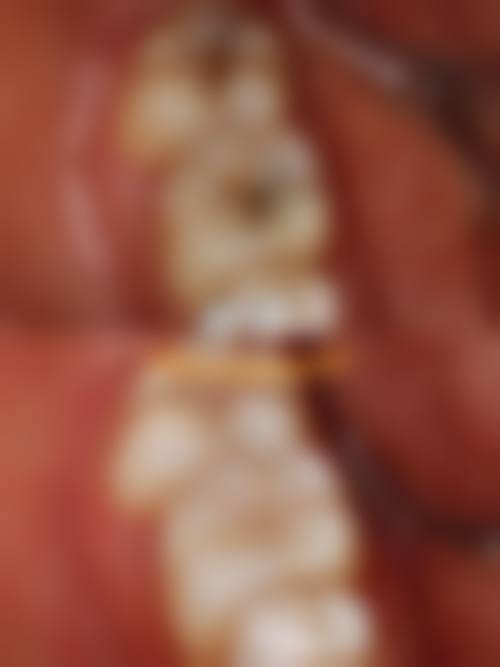 {忻州牙科医院在线咨询24小时，选哪家不踩坑？恒伦、和平、美益达技术好价格优！ 