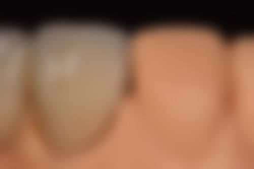 罗医生技术优势