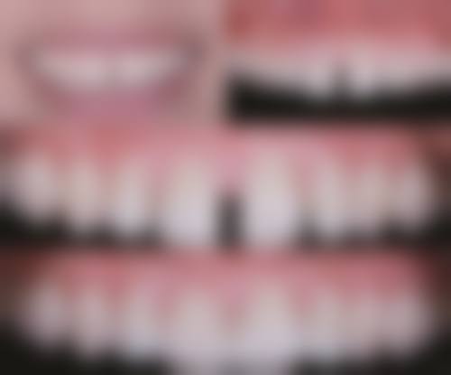 罗医生技术优势