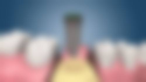 揭阳诺贝尔口腔医院各项收费标准