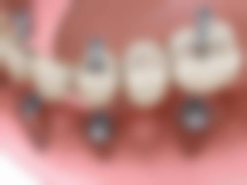 湖南张家界慈利博雅口腔价格表/收费标准