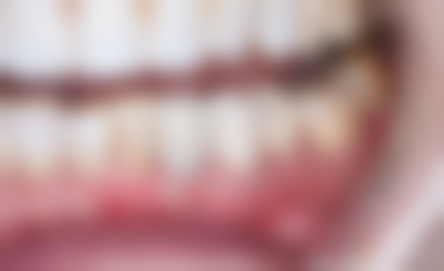 西安未央爱牙乐口腔诊所特色项目及技术优势