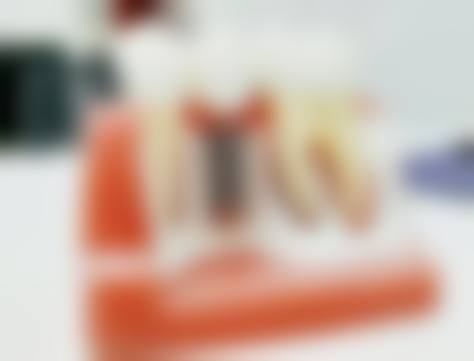 四、两家医院舌侧矫正的技术对比