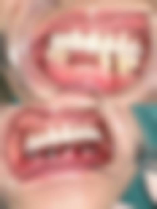 常熟明日口腔:多分店服务,种牙便捷无忧