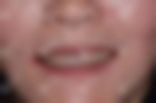 上海雅悦齿科顾村公园店地址电话 | 地址在宝山区陆翔路111号，电话021 - 56298xxx ！该店种牙技术领先，美国进口种植牙套餐4111元起！ 