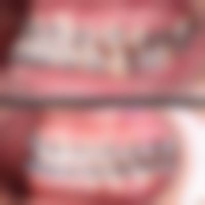 提升实力：黄冈皓清齿科医生技术培养