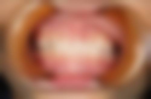 西安未央爱牙乐口腔诊所真人口碑评价怎么样？