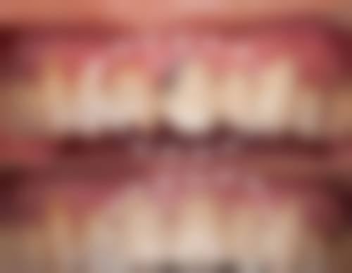 四川乐山德立口腔价格表/收费标准