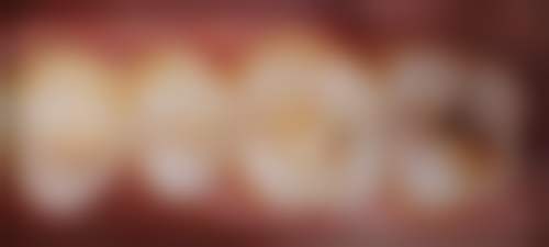 安心就诊：黄冈皓清齿科消毒措施