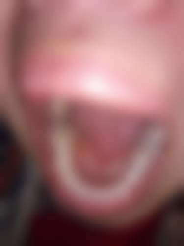 天津津诚口腔塘沽门诊部真人口碑评价怎么样?