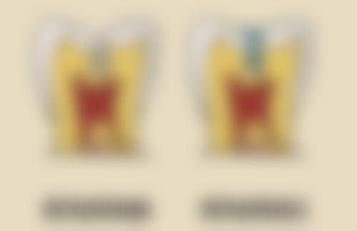 暑期特别优惠：黄冈皓清齿科收费价格