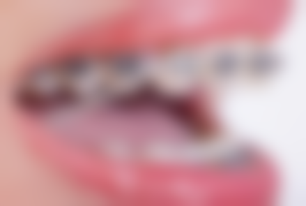 太原市杏花岭区皓齿口腔门诊部地址电话营业时间