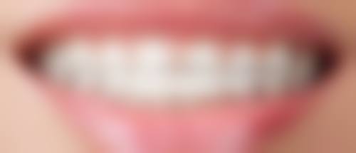 拔牙以后出血多久停？大多24小时内停止，48小时内唾液带血丝属正常现象