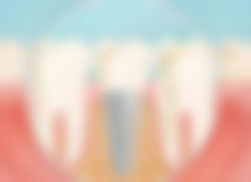 广东东莞好牙匠口腔诊所真人口碑评价怎么样？