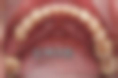 广西防城港防城黄明口腔特色项目及技术优势