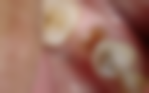 蔡江宏医生擅长项目