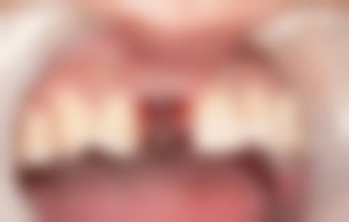 罗医生预约挂号