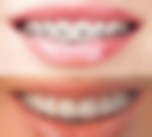 深圳正夫口腔：合理收费与优惠活动齐飞