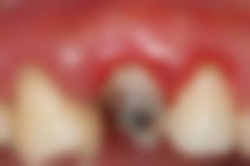 五、濮阳现代义齿：专注义齿业务订单