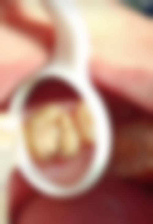 呼和浩特侯青口腔诊所真人口碑评价怎么样?