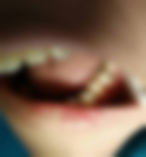 益阳德益口腔补牙医生技术特色