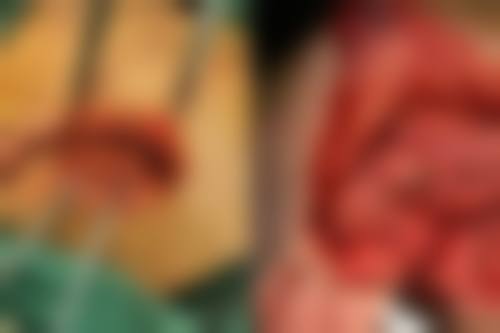 广东韶关仁化爱牙口腔诊所真人口碑评价怎么样?