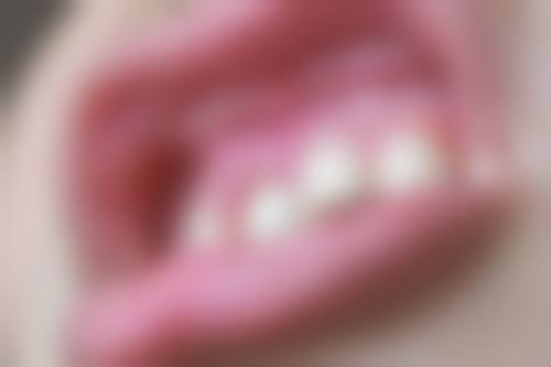 三、濮阳市油田总医院口腔科：临床特色专科之选