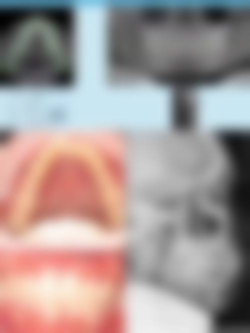 二、濮阳市第三人民医院口腔科：老牌口腔防治中 心